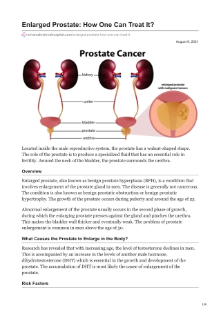 Enlarged Prostate How One Can Treat It