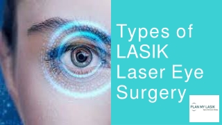 Types of Lasik Laser Eye Surgery