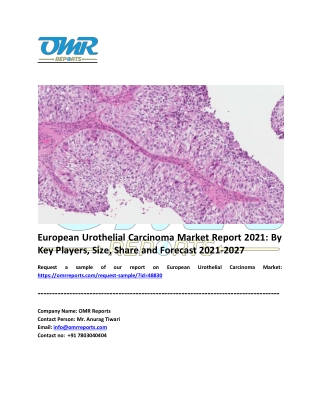 European Urothelial Carcinoma Market Size, Share, Analysis, Forecast 2021-2027