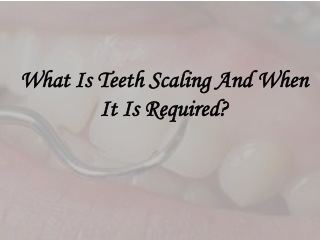What Is Teeth Scaling And When It Is Required