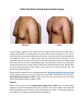 Useful Tips Before Having Gynecomastia Surgery