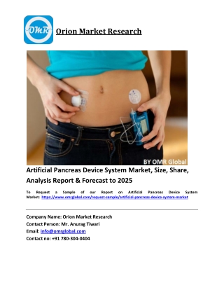 Artificial Pancreas Device System Market Size, Share and Forecast 2019-2025