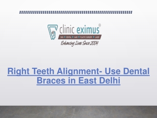 Right Teeth Alignment- Use Dental Braces in East Delhi