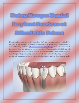 Baton Rouge_ Dental Implant Services At Affordable Prices-converted