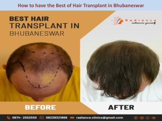 How to have the Best of Hair Transplant in Bhubaneswar