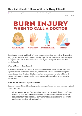 How bad should a Burn for it to be Hospitalized