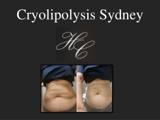 Cryolipolysis Sydney