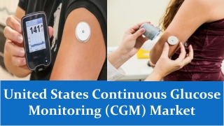 United States Continuous Glucose Monitoring (CGM) Market 2021 - 2027