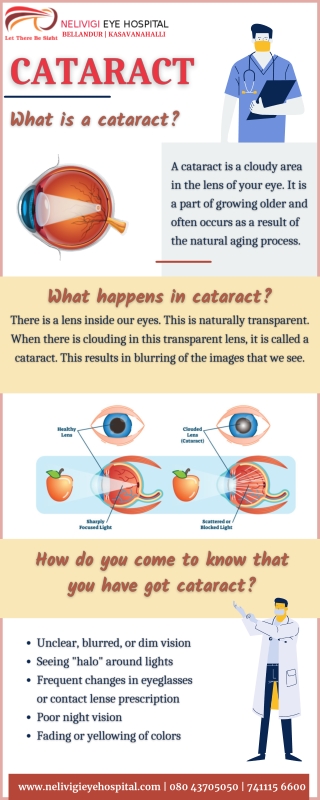 Best Cataract Surgery - Best Eye Hospitals in Bellandur, Bangalore - Nelivigi Eye Hospital