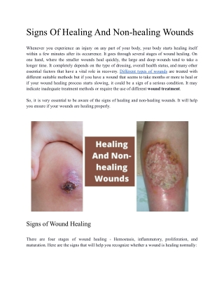 Signs Of Healing And Non-healing Wounds