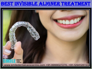 Best Invisible Aligner Treatment By Dr. Garg