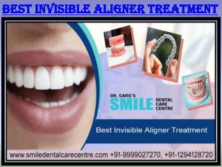 Best Invisible Aligner Treatment By Latest Technologies