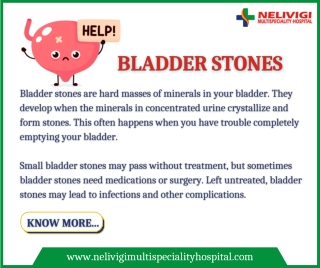 Bladder stones - Best Urology Hospitals in Bangalore - Nelivigi Urology`