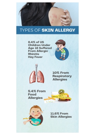 Types of Allergy