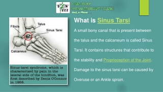 Causes of Sinus Tarsi Syndrome  - Pain Free Physiotherapy Clinic