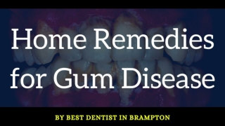 Home Remedies for Gum Disease by the Best Dentist in Brampton