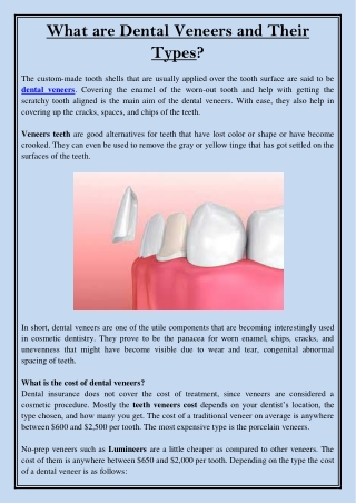What are Dental Veneers and Their Types