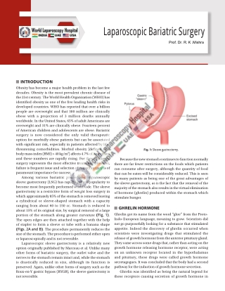 Laparoscopic-Bariatric-Surgery