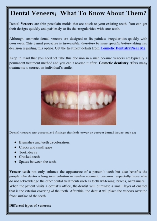 Dental Veneers;  What To Know About Them