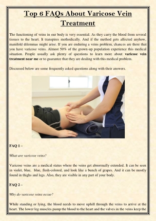 Top 6 FAQs About Varicose Vein Treatment
