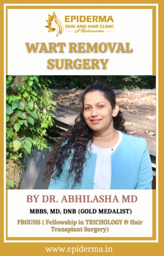 Wart Removal Surgery | Best Dermatologists In Jayanagar, Bangalore | Dr Abhilash