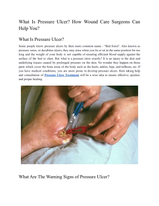 What Is Pressure Ulcer? How Wound Care Surgeons Can Help You?