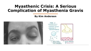 Myasthenia gravis