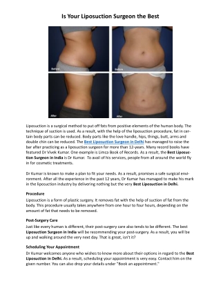 Is Your Liposuction Surgeon the Best