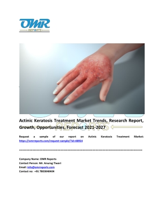 Actinic Keratosis Treatment Market Analysis Report, Share and Forecast 2021-2027