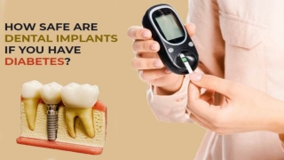 HOW SAFE ARE DENTAL IMPLANTS IF YOU HAVE DIABETES_