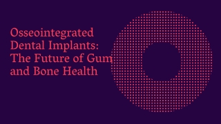 Osseointegrated Dental Implants The Future of Gum and Bone Health