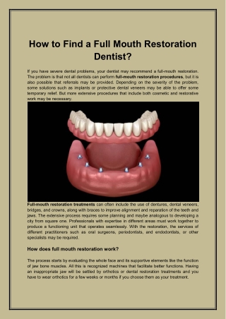 How to Find a Full Mouth Restoration Dentist