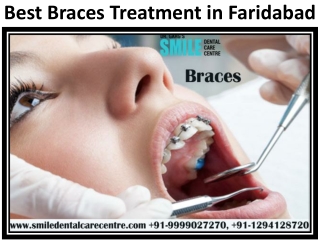 To Get Best Braces Treatment and Experienced Orthodontist in Faridabad Contact u