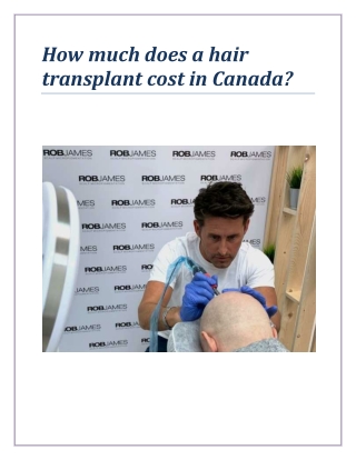How much does a hair transplant cost in Canada