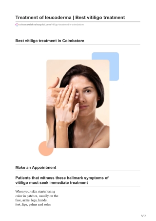 Treatment of leucoderma|Best vitiligo treatment|Vitiligo specialist In Coimbatore