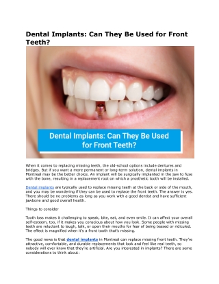 Dental Implants: Can They Be Used for Front Teeth? - Alpha Dental Clinic