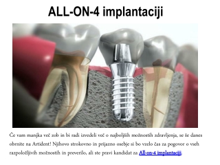 ALL-ON-4 implantaciji