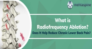 What is Radiofrequency Ablation? Does It Help Reduce Chronic Lower Back Pain?