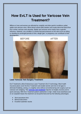 How EvLT is Used for Varicose Vein Treatment