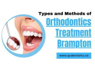 Types and Methods of Orthodontics treatment Chinguacousy RD