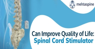 Can Improve Quality of Life: Spinal Cord Stimulator