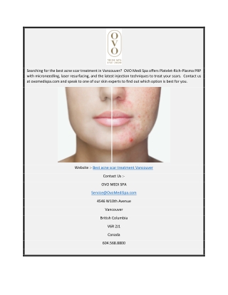 Best Acne Scar Treatment Vancouver  Ovomedispa.com