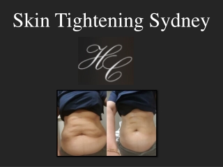 Skin Tightening Sydney