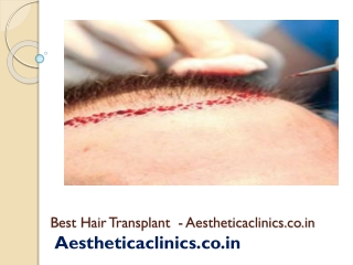 Best Hair Transplant  - Aestheticaclinics.co.in