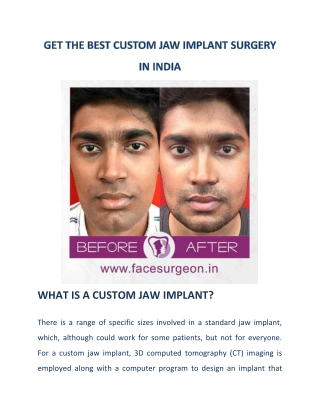 Get the best custom jaw implant surgery in india