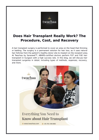 Does Hair Transplant Really Work? The Procedure, Cost, and Recovery
