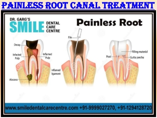 Know Where to Get Painless Root Canal Treatment