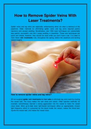 How to Remove Spider Veins With Laser Treatments