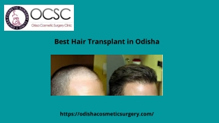 Best Hair Transplant in Odisha