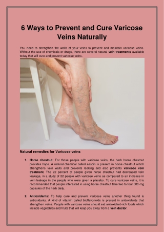 6 Ways to Prevent and Cure Varicose Veins Naturally